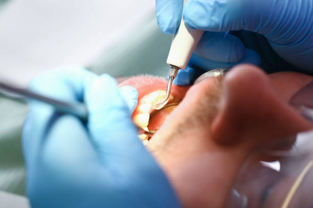 Best Emergency Dental Extractions in Greenup, IL