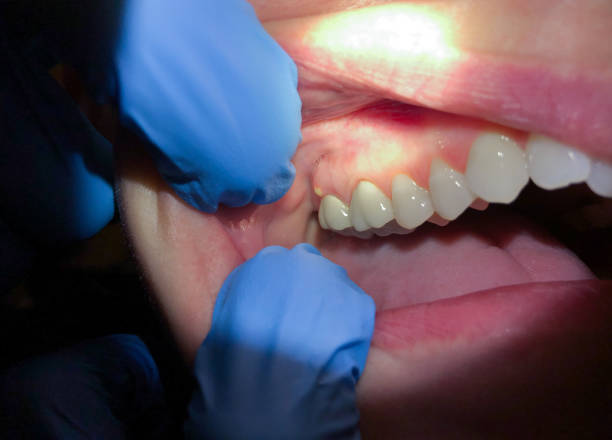 Best Emergency Root Canal Treatment in Greenup, IL