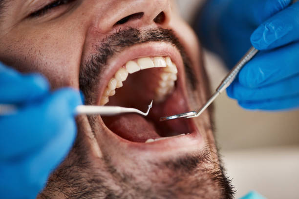Best Emergency Dentist for Special Needs Patients in Greenup, IL
