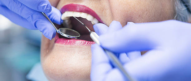 Best Broken or Cracked Tooth Emergency Dentist in Greenup, IL