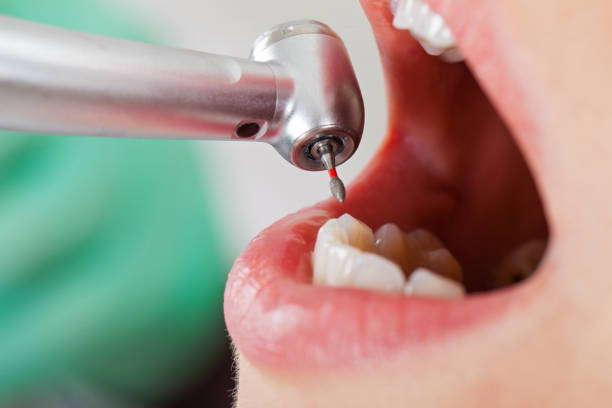 Best Broken or Cracked Tooth Emergency Dentist in Greenup, IL